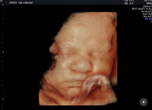 Gesicht 3D 36. Woche 2