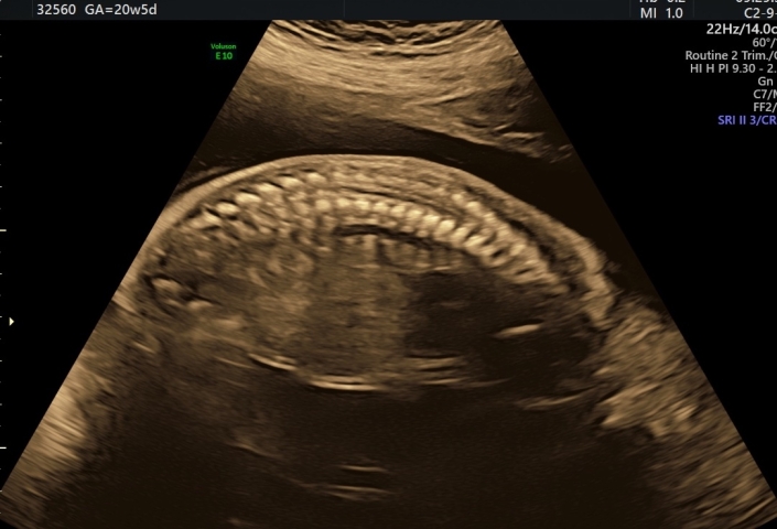 Rücken und Wirbelsäule